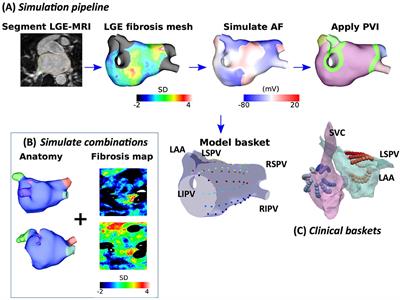 Time-Averaged Wavefront Analysis Demonstrates Preferential Pathways of Atrial Fibrillation, Predicting Pulmonary Vein Isolation Acute Response